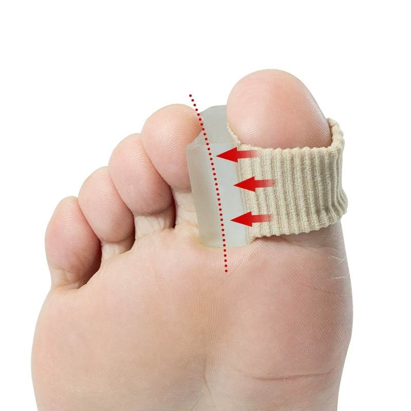 Toe Separator Silicon - 1/10個入り 1/2/3/4/5穴 ファイバー製足指矯正器 外反母趾 ビッグフット 骨の重なりを直す足指セパレーター