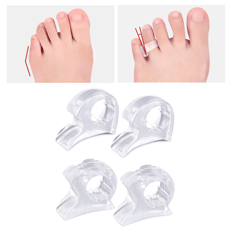 シリコンフットケアツール,外反母趾矯正器,外反母趾矯正用ハン - Toe Separator Silicon のレビューと価格