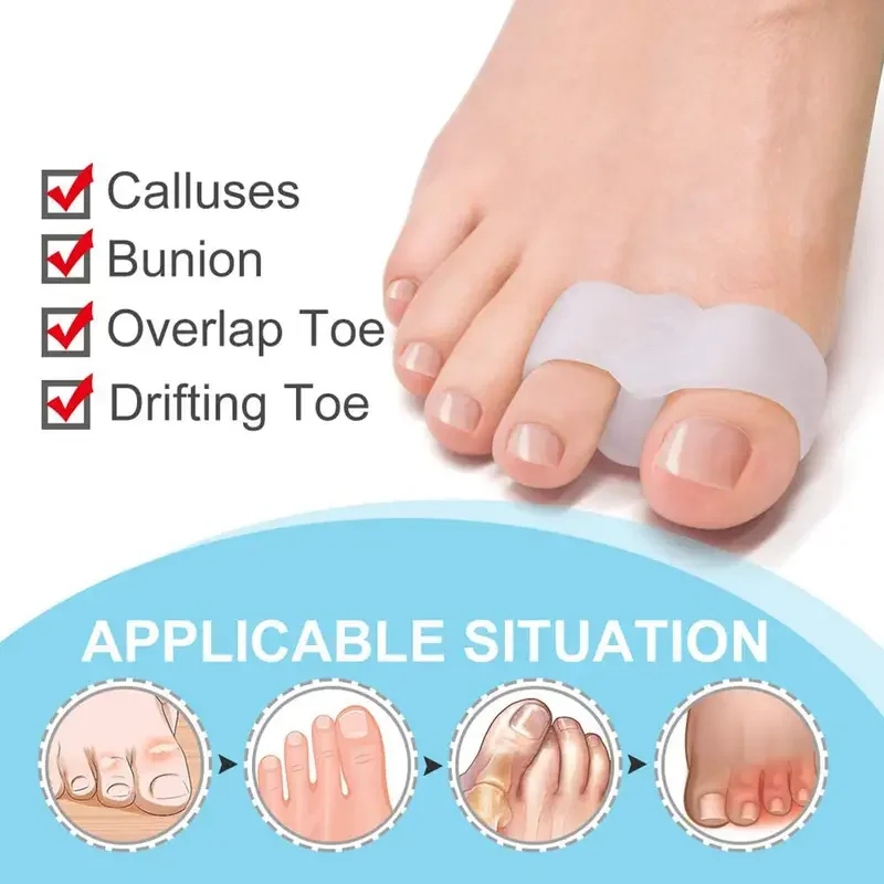 外反母趾矯正サポーター 1組 - 快適で通気性の良いシリコン - Toe Separator Silicon のレビューと価格